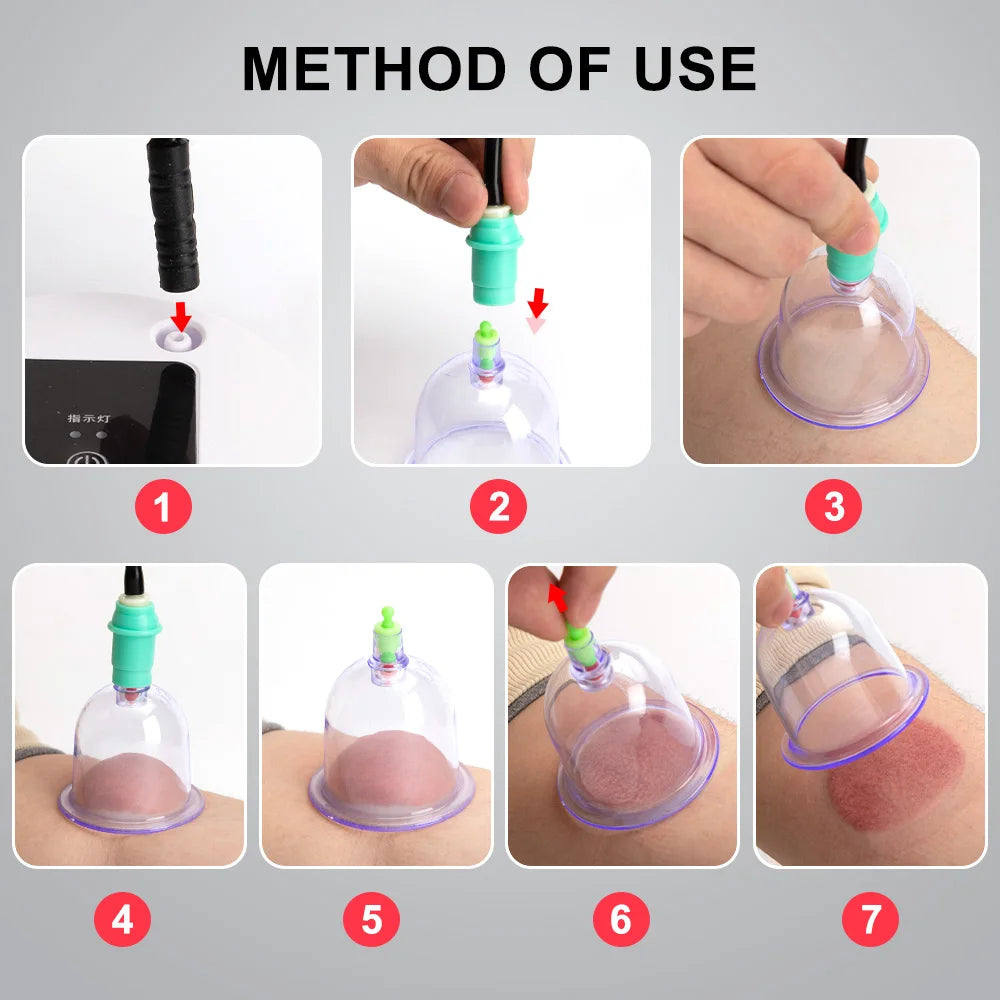 Electric Vacuum Cupping Body Massager