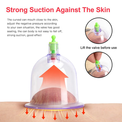Electric Vacuum Cupping Body Massager